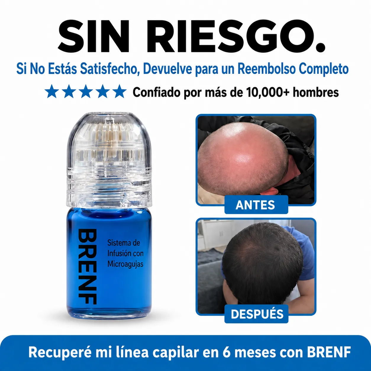 El Sistema de Regeneración Capilar con Infusión de Péptidos Más Potente